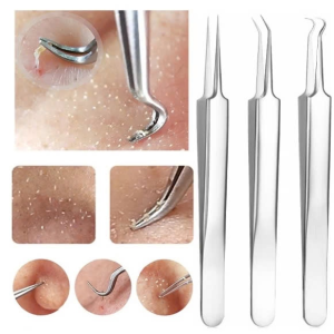 NHÍP LẤY MỤN CHIỀU DÀI 8.7 CM